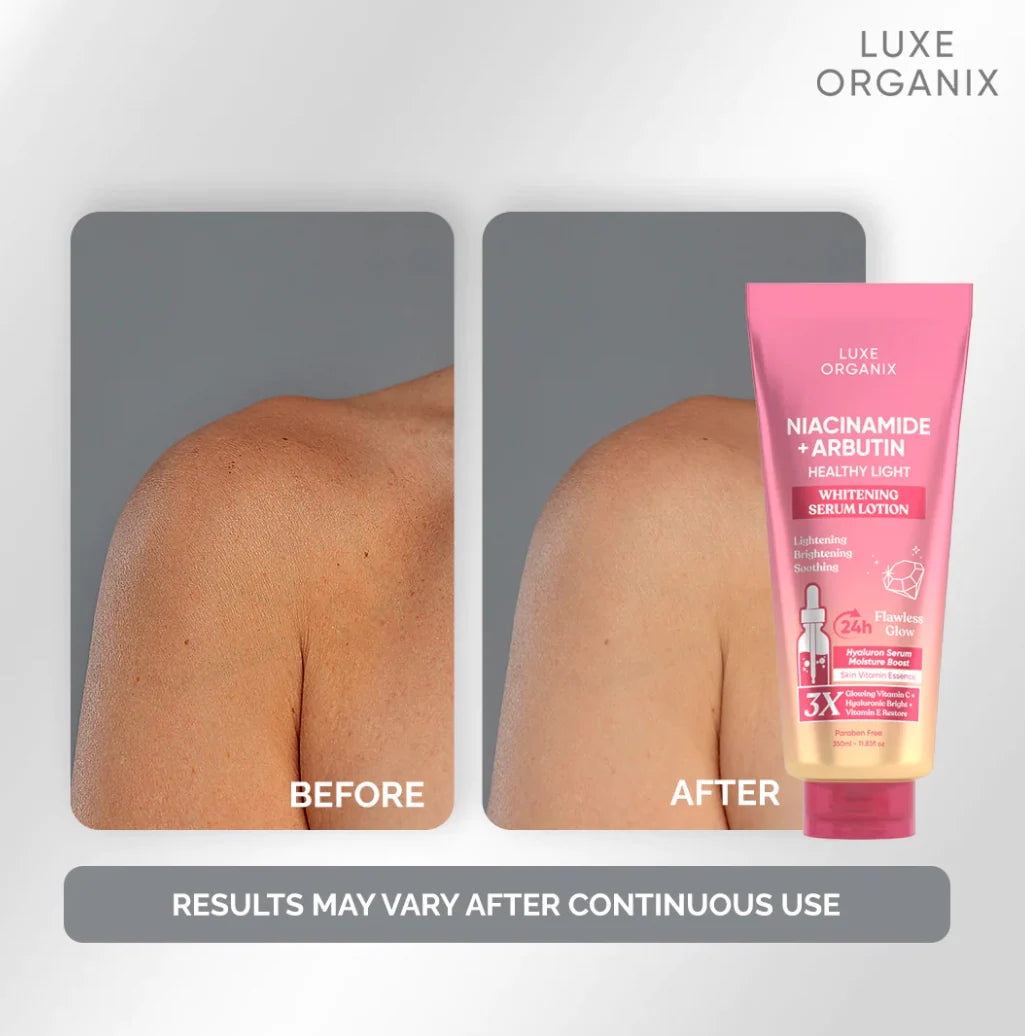 Luxe Organix Niacinamide + Alpha Arbutin Whitening Serum Lotion 350ml