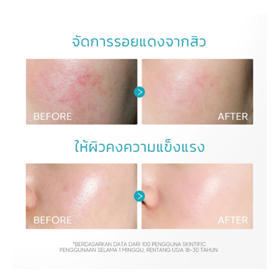 SKINTIFIC 5% Panthenol Acne Calming Water Gel 7G Sachet
